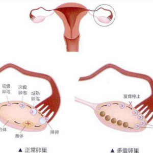 浙江帮人助孕孩子?(浙江哪里看生殖科好)